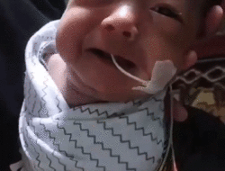 Humairah Azzahra Derita Atresia Koana, Butuh Susu Formula Khusus, Uluran Tangan Dermawan Sangat Dinanti 4 Humairah Azzahra Derita Atresia Koana, Butuh Susu Formula Khusus, Uluran Tangan Dermawan Sangat Dinanti