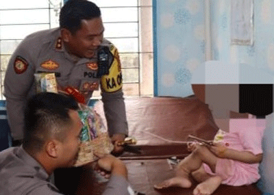 Kapolres Nias Selatan (berdiri) datangi bocah yang diduga jadi korban penyiksaan.