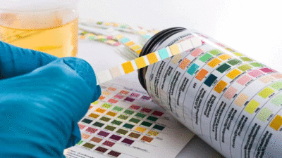 Ilustrasi tes urine.