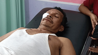Ayub menjalani perawatan setelah diserang sekelompok orang.
