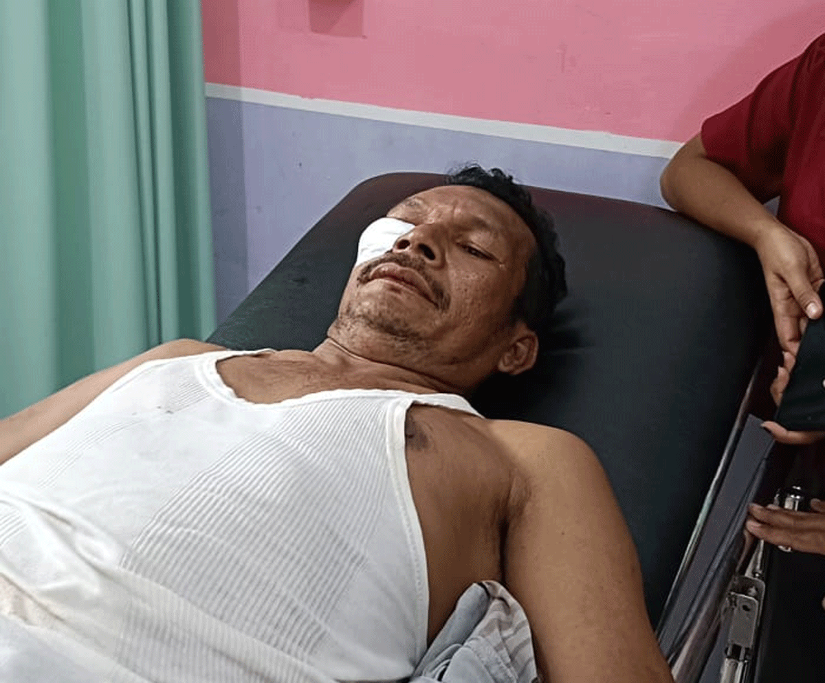 Ayub menjalani perawatan setelah diserang sekelompok orang.