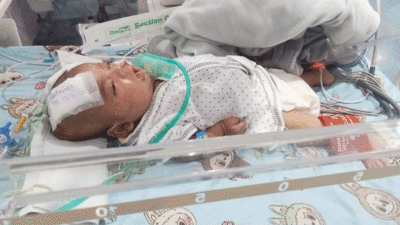 Seorang anak balita asal Payakumbuh tengah berjuang melawan penyakit jantung bawaan yang dideritanya sejak lahir.