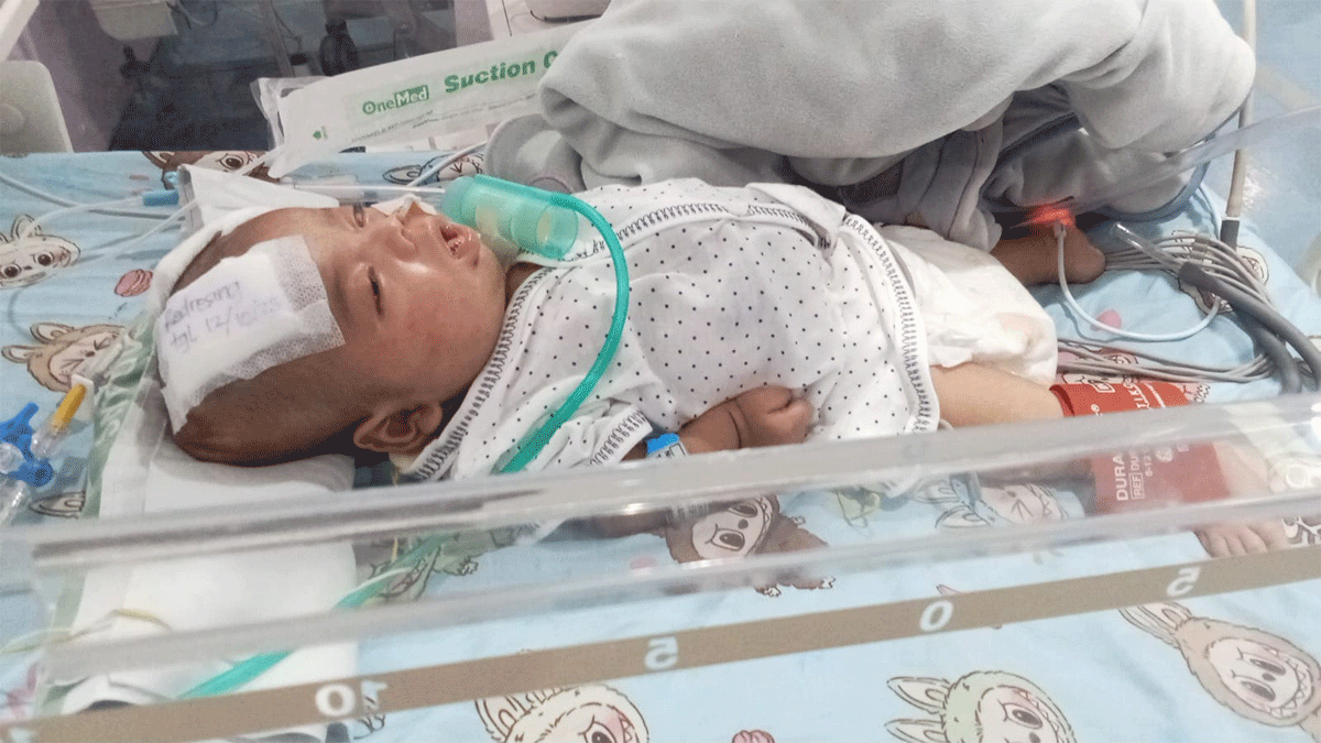 Seorang anak balita asal Payakumbuh tengah berjuang melawan penyakit jantung bawaan yang dideritanya sejak lahir.